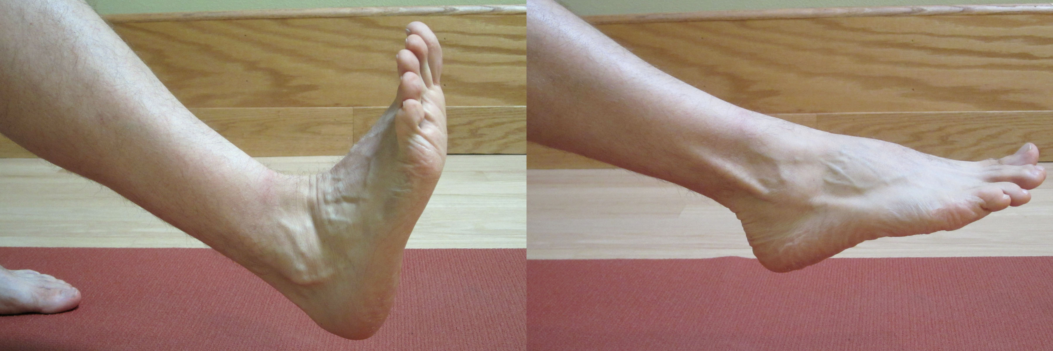 Ankle Sprain Rehab Exercises  Mobilisation, Jumps, Stability 