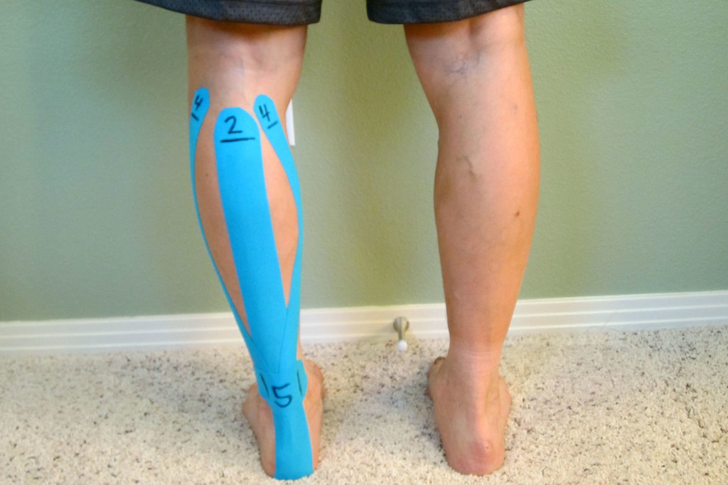 Does Kinesio Tape Work?