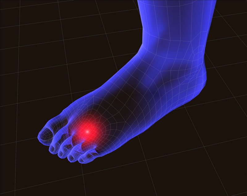 Examine These Tips For Identifying And Treating Heel Fractures