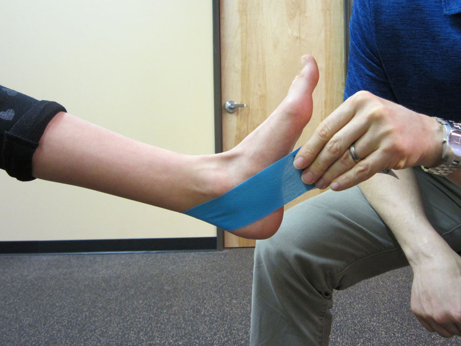 vandtæt Mængde af Colonial Taping for Posterior Tibialis Tendon Dysfunction (PTTD) | The Physical  Therapy Advisor