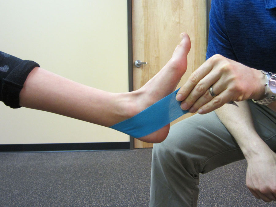 Taping for Posterior Tibialis Tendon Dysfunction (PTTD)